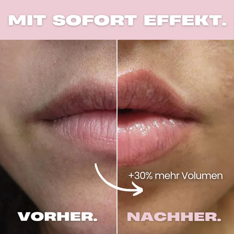 LIPLIFT LIPPEN ROLLER